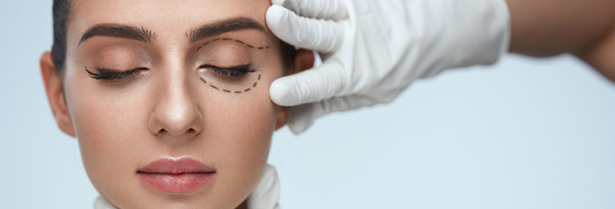 Blépharoplastie supérieure