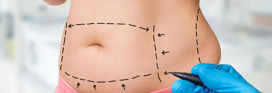 chirurgie esthétique