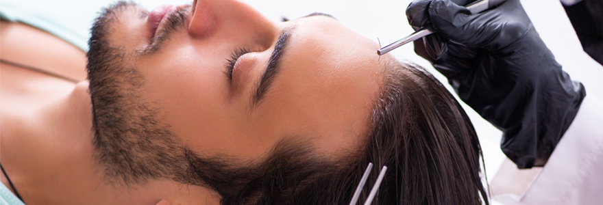 Micro greffes de cheveux